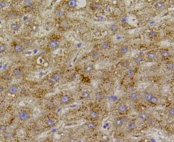 VEGFR1 Polyclonal Antibody, Huabio 100 &mu;L; Unconjugated:Antibodies,