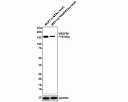 VEGFR1 Polyclonal Antibody, Huabio 100 &mu;L; Unconjugated:Antibodies,