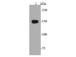 VEGFR1 Polyclonal Antibody, Huabio 100 &mu;L; Unconjugated:Antibodies,