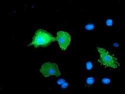 ERBB2 Monoclonal Antibody (OTI1D9), TrueMAB , OriGene 100 &mu;L; Unconjugated:Antibodies,