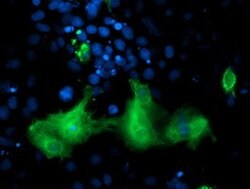 ERBB2 Mouse anti-Human, Clone: OTI4G10, lyophilized, TrueMAB 100 &mu;g;