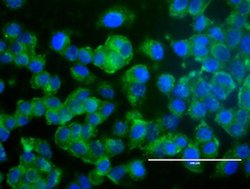 ERBB2 Monoclonal Antibody (OTI6F3), TrueMAB , OriGene 100 &mu;L; Unconjugated:Antibodies,