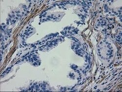 ERBB2 Monoclonal Antibody (OTI1D9), TrueMAB , OriGene 100 &mu;L; Unconjugated:Antibodies,