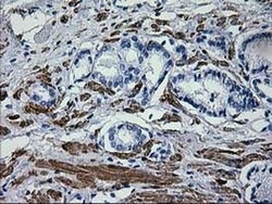 ERBB2 Monoclonal Antibody (OTI1D9), TrueMAB , OriGene 100 &mu;L; Unconjugated:Antibodies,