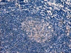 ERBB2 Monoclonal Antibody (OTI1D9), TrueMAB , OriGene 100 &mu;L; Unconjugated:Antibodies,