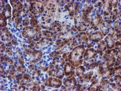 ERBB2 Mouse anti-Human, Clone: OTI4G10, lyophilized, TrueMAB 100 &mu;g;