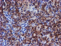 ERBB2 Monoclonal Antibody (OTI4G10), TrueMAB , OriGene 100 &mu;L; Unconjugated:Antibodies,