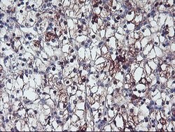 ERBB2 Mouse anti-Human, Clone: OTI4G10, lyophilized, TrueMAB 100 &mu;g;