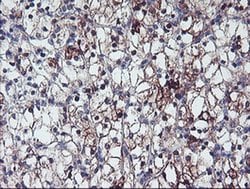 ERBB2 Monoclonal Antibody (OTI4G10), TrueMAB , OriGene:Antibodies:Primary