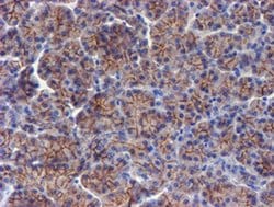 ERBB2 Monoclonal Antibody (OTI12G4), TrueMAB , OriGene 30 &mu;L; Unconjugated:Antibodies,
