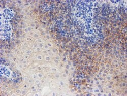 ERBB2 Monoclonal Antibody (OTI12G4), TrueMAB , OriGene:Antibodies:Primary