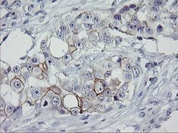 ERBB2 Monoclonal Antibody (OTI6F3), TrueMAB , OriGene:Antibodies:Primary