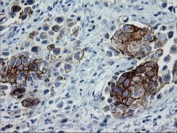ERBB2 Monoclonal Antibody (OTI6F3), TrueMAB , OriGene:Antibodies:Primary