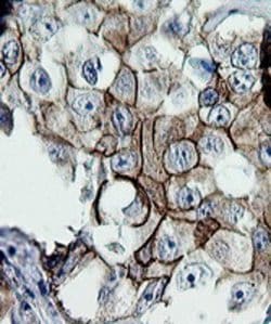 ERBB2 Mouse anti-Human, Clone: OTI5C3, lyophilized, TrueMAB 100 &mu;g;