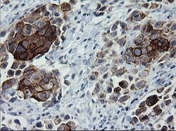 ERBB2 Mouse anti-Human, Clone: OTI5C3, lyophilized, TrueMAB 100 &mu;g;