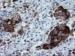 ERBB2 Monoclonal Antibody (OTI4G7), TrueMAB , OriGene:Antibodies:Primary