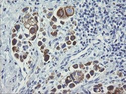 ERBB2 Monoclonal Antibody (OTI2A1), TrueMAB , OriGene 100 &mu;L; Unconjugated:Antibodies,