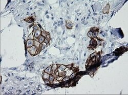 ERBB2 Monoclonal Antibody (OTI5C4), TrueMAB , OriGene 30 &mu;L; Unconjugated:Antibodies,