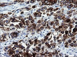 ERBB2 Monoclonal Antibody (OTI5C4), TrueMAB , OriGene 30 &mu;L; Unconjugated:Antibodies,