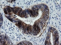 ERBB2 Monoclonal Antibody (OTI5C4), TrueMAB , OriGene 30 &mu;L; Unconjugated:Antibodies,