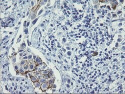 ERBB2 Mouse anti-Human, Clone: OTI7C2, lyophilized, TrueMAB 100 &mu;g;