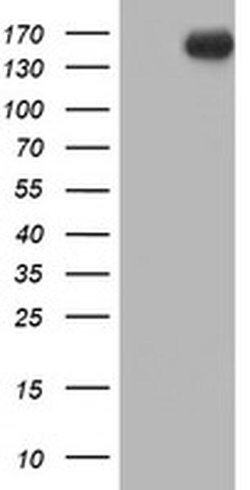 ERBB2 Monoclonal Antibody (OTI4F10), TrueMAB , OriGene 100 &mu;L; Unconjugated:Antibodies,