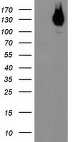 ERBB2 Monoclonal Antibody (OTI1D9), TrueMAB , OriGene 100 &mu;L; Unconjugated:Antibodies,