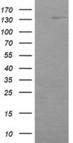 ERBB2 Mouse anti-Human, Clone: OTI4G10, lyophilized, TrueMAB 100 &mu;g;