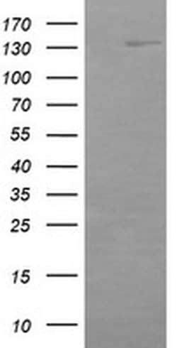 ERBB2 Monoclonal Antibody (OTI4G10), TrueMAB , OriGene:Antibodies:Primary
