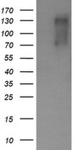 ERBB2 Monoclonal Antibody (OTI6H10), TrueMAB , OriGene 100 μL; Unconjugated:Antibodies,
