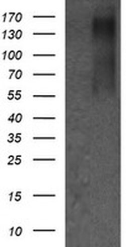 ERBB2 Monoclonal Antibody (OTI6F3), TrueMAB , OriGene 100 &mu;L; Unconjugated:Antibodies,
