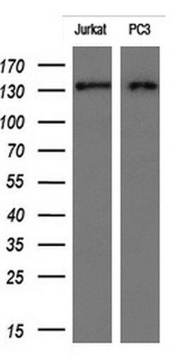 ERBB2 Monoclonal Antibody (OTI6F3), TrueMAB , OriGene 100 &mu;L; Unconjugated:Antibodies,