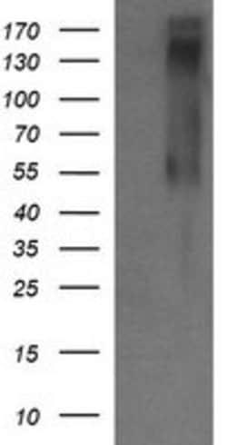 ERBB2 Mouse anti-Human, Clone: OTI5C3, lyophilized, TrueMAB 100 &mu;g;
