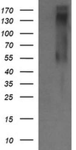ERBB2 Monoclonal Antibody (OTI5C3), TrueMAB , OriGene 30 &mu;L; Unconjugated:Antibodies,