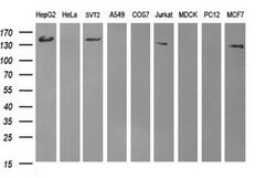 ERBB2 Mouse anti-Human, Clone: OTI5C3, lyophilized, TrueMAB 100 &mu;g;