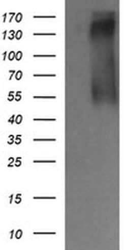 ERBB2 Monoclonal Antibody (OTI4G7), TrueMAB , OriGene 100 &mu;L; Unconjugated:Antibodies,