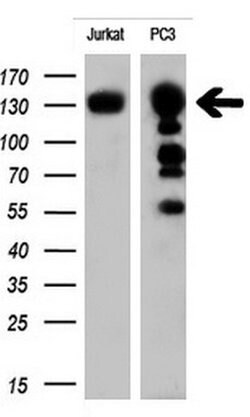 ERBB2 Monoclonal Antibody (OTI4G7), TrueMAB , OriGene 100 &mu;L; Unconjugated:Antibodies,