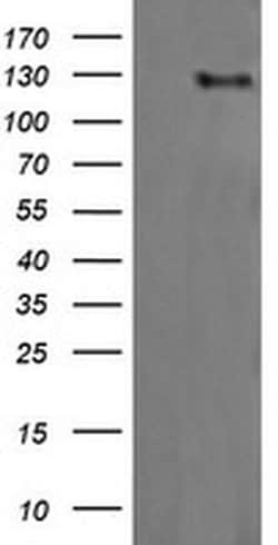ERBB2 Monoclonal Antibody (OTI2G9), TrueMAB , OriGene 100 &mu;L; Unconjugated:Antibodies,