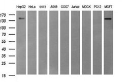 ERBB2 Monoclonal Antibody (OTI2G9), TrueMAB , OriGene 100 &mu;L; Unconjugated:Antibodies,