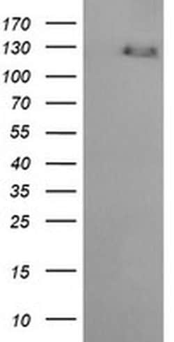 ERBB2 Monoclonal Antibody (OTI6G9), TrueMAB , OriGene:Antibodies:Primary