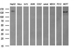 ERBB2 Monoclonal Antibody (OTI6G9), TrueMAB , OriGene 100 &mu;L; Unconjugated:Antibodies,