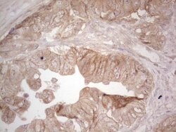 ERBB3 Monoclonal Antibody (OTI1A5), TrueMAB , OriGene 100 &mu;L; Unconjugated:Antibodies,