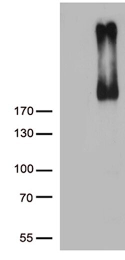 ERBB3 Mouse anti-Human, Clone: OTI1A6, lyophilized, TrueMAB 100 &mu;g;