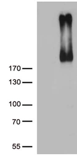 ERBB3 Monoclonal Antibody (OTI1A6), TrueMAB , OriGene 100 &mu;L; Unconjugated:Antibodies,