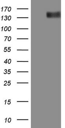ERBB3 Monoclonal Antibody (OTI1A5), TrueMAB , OriGene:Antibodies:Primary