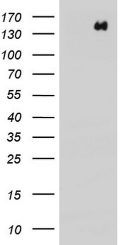 ERBB4 Monoclonal Antibody (OTI1D9), TrueMAB , OriGene 100 &mu;L; Unconjugated:Anticuerpos
