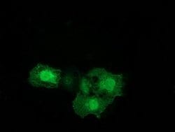 ERCC1 Monoclonal Antibody (OTI1H1), TrueMAB , OriGene 30 &mu;L; Unconjugated:Antibodies,