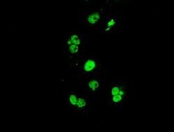 ERCC1 Monoclonal Antibody (OTI24F2), TrueMAB , OriGene 30 &mu;L; Unconjugated:Antibodies,