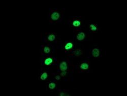 ERCC1 Mouse anti-Human, Clone: OTI5E6, lyophilized, TrueMAB 100 &mu;g;