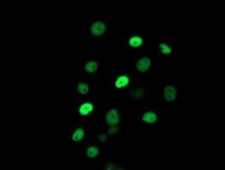 ERCC1 Monoclonal Antibody (OTI5E6), TrueMAB , OriGene 30 &mu;L; Unconjugated:Antibodies,